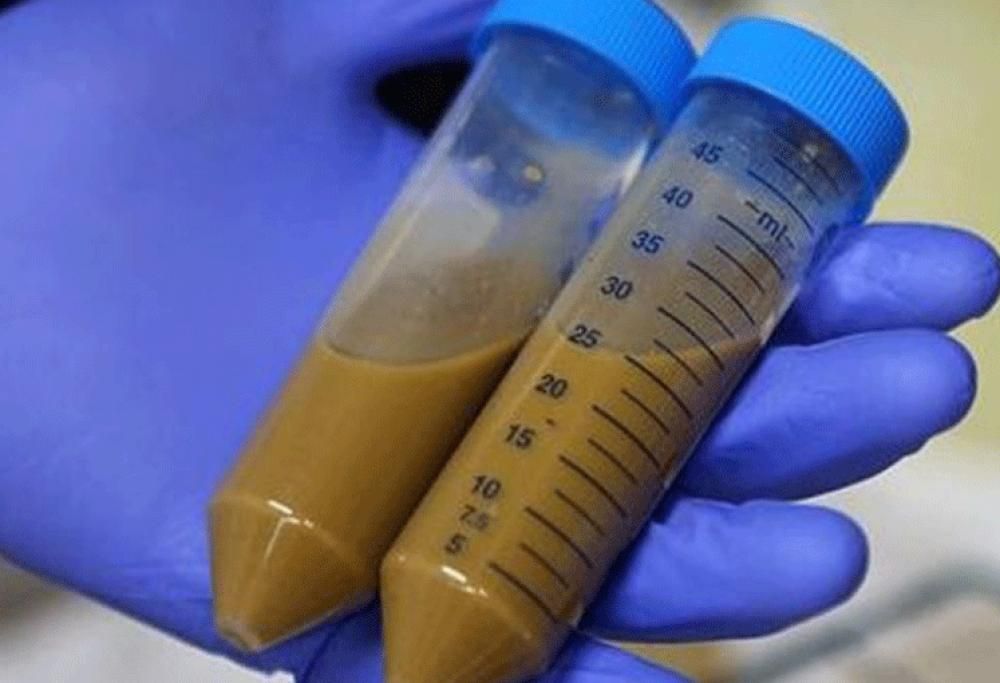 La banca della Cacca: guadagnare defecando!