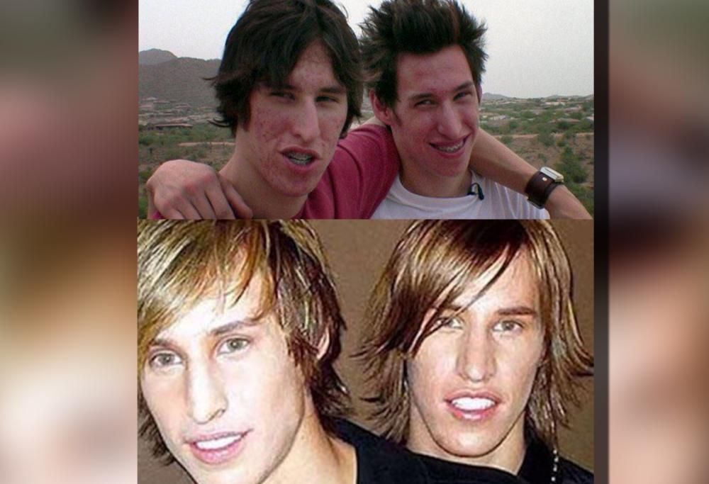 QUESTI GEMELLI HANNO SPESO 15 MILA EURO PER SOMIGLIARE A BRAD PITT