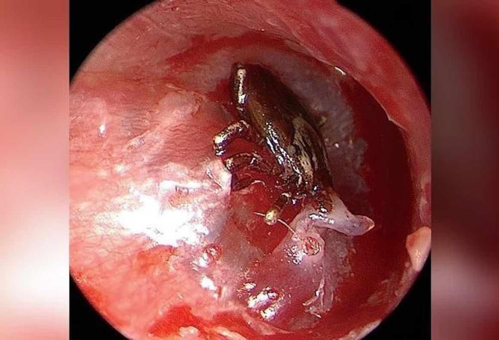 Bimbo ha dolori all’orecchio,  i medici scoprono una presenza inquietante al suo interno