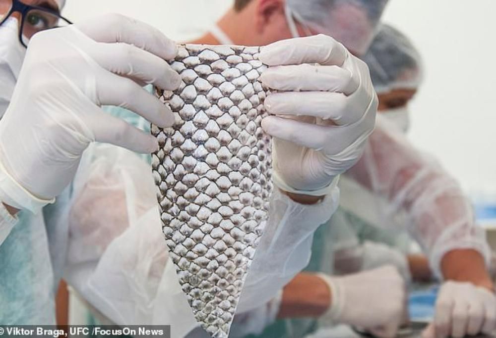 Donna Transgender diventa la prima al mondo a ricevere una vagina realizzata con pelle di pesce!