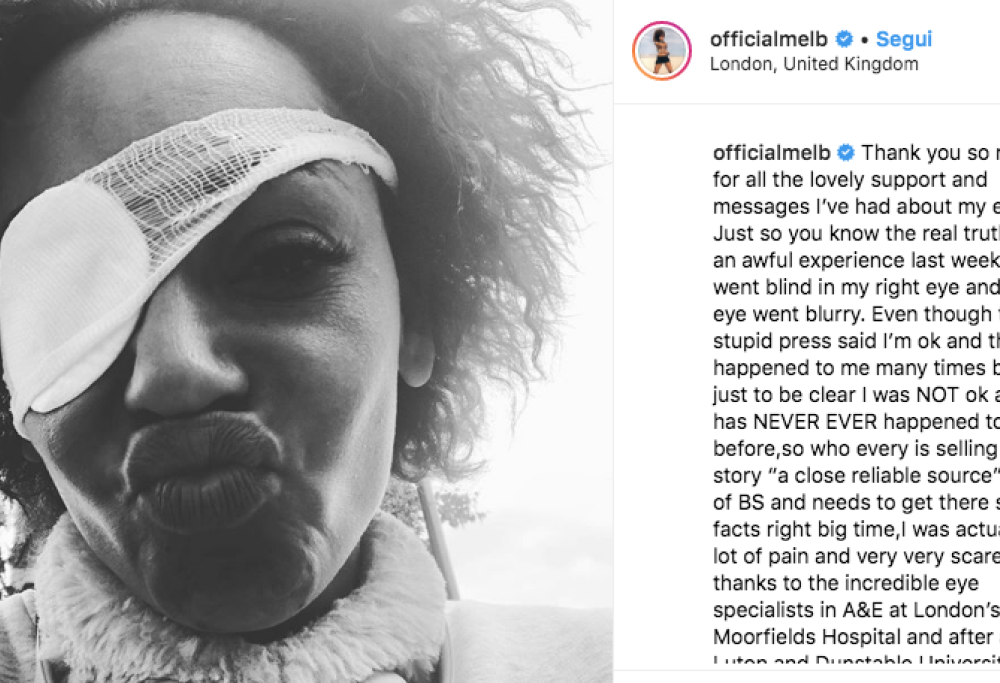 Spice Girls, Mel B non è diventata cieca: “Ho solo un’infezione che sto curando”