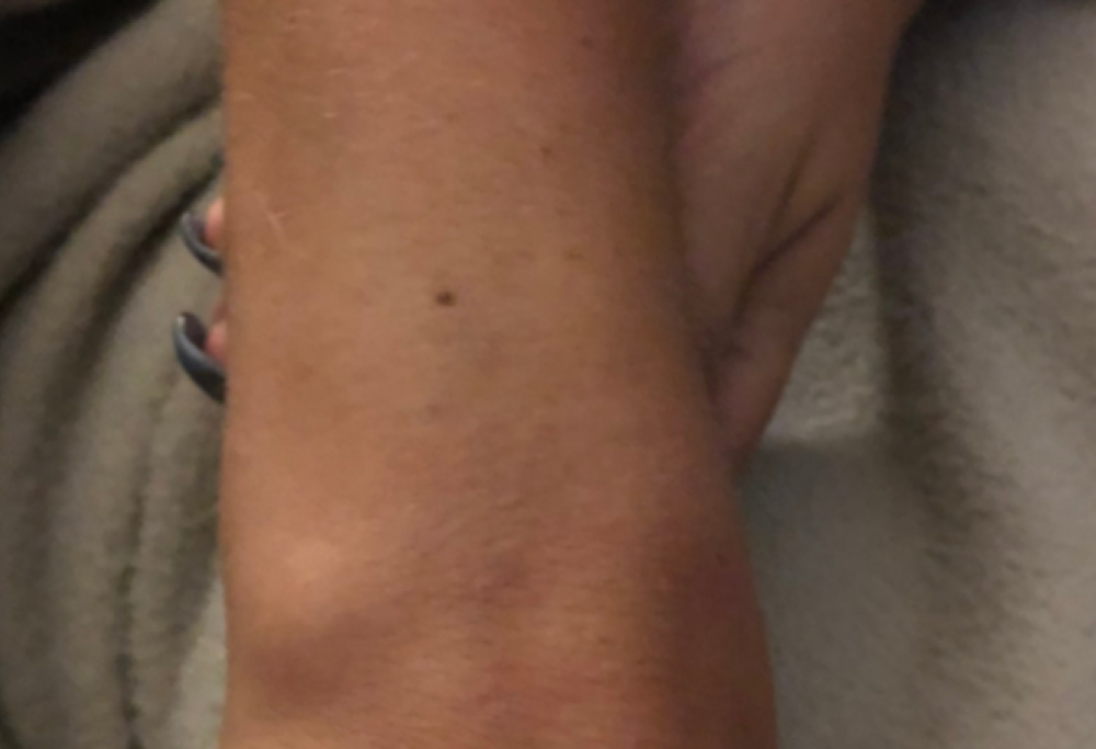 Migliaia di donne hanno un neo nello stesso identico posto. Tu sei fra quelle?