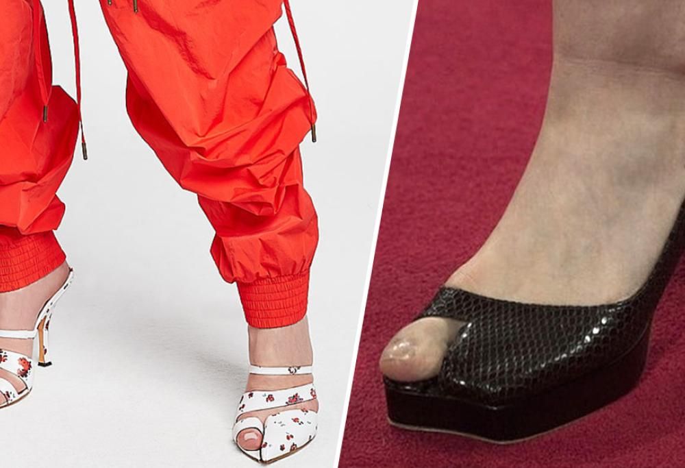 Nuova moda del momento: arrivano le scarpe “alluce”!