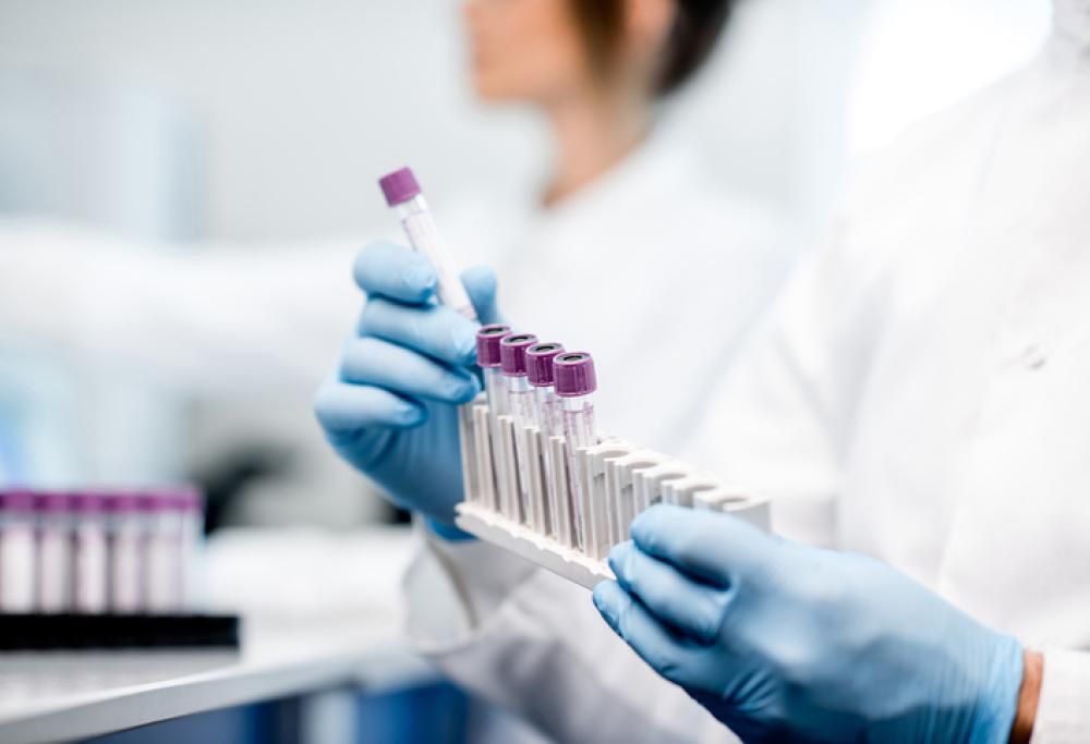Contrae l’Hiv nel laboratorio dell’Università durante la tesi