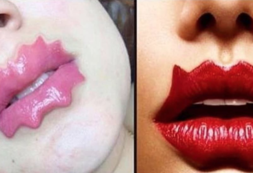 Le Devil Lips sono la nuova (folle) moda della chirurgia estetica