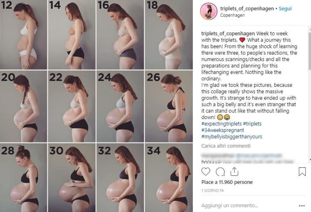 Mamma di tre gemelli mostra le trasformazioni in gravidanza su Instagram