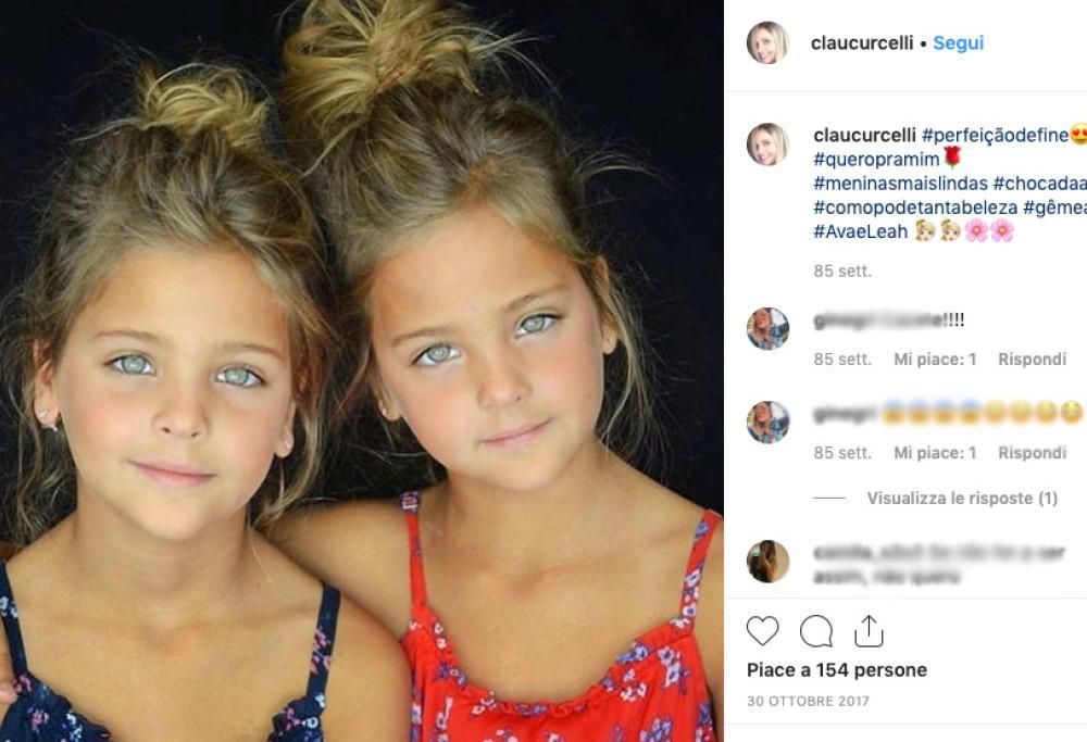 Guarda come sono diventate Ava e Leah, le gemelle più belle del mondo