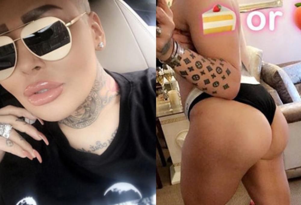 Il sosia di Kim Kardashian rischia la vita per un intervento al sedere