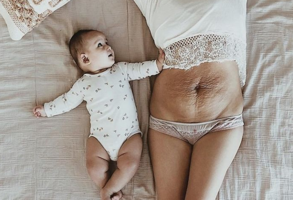 Il corpo femminile, dopo la gravidanza, è comunque bellissimo (e questa mamma lo dimostra)