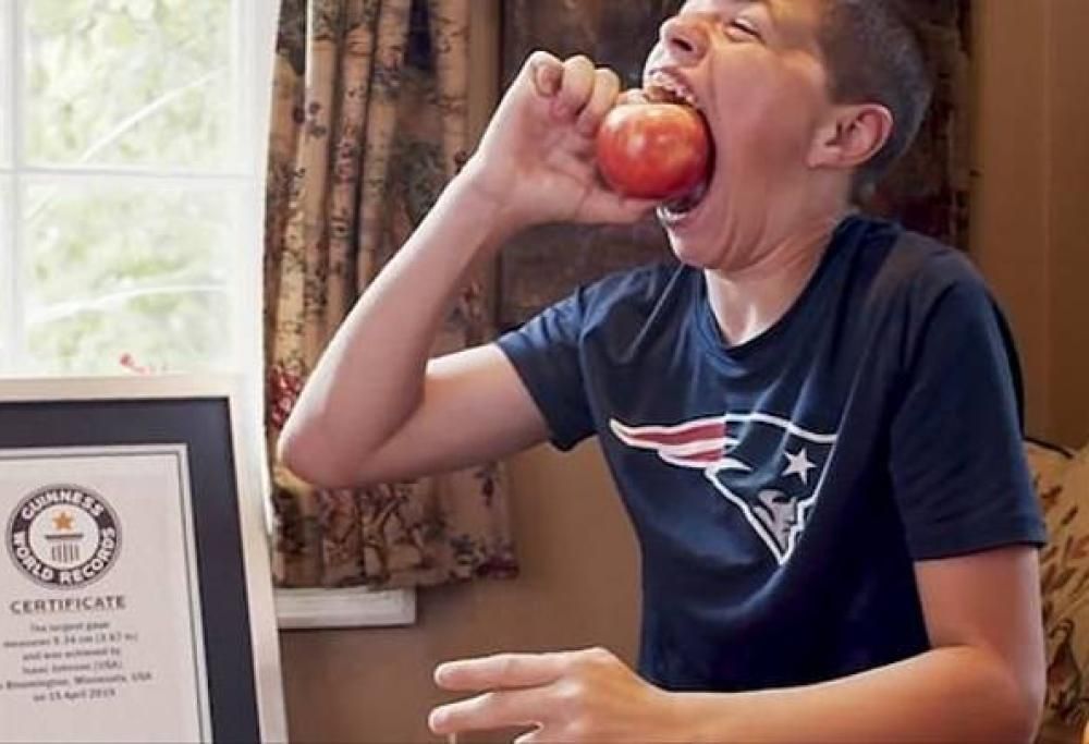 Ragazzino di 14 anni batte il record di bocca più grande del mondo!