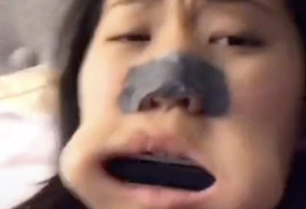 Utente di Tik Tok si è ritrovata con un’armonica bloccata in bocca!