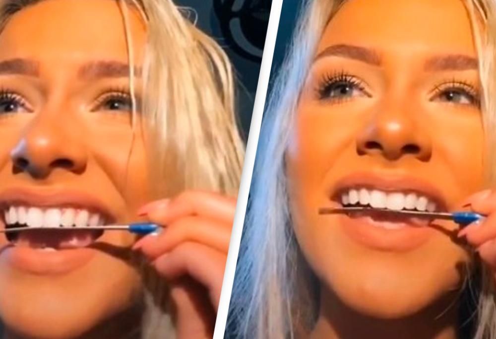 TikTok: l’assurda tendenza di limarsi i denti con le lime per le unghie