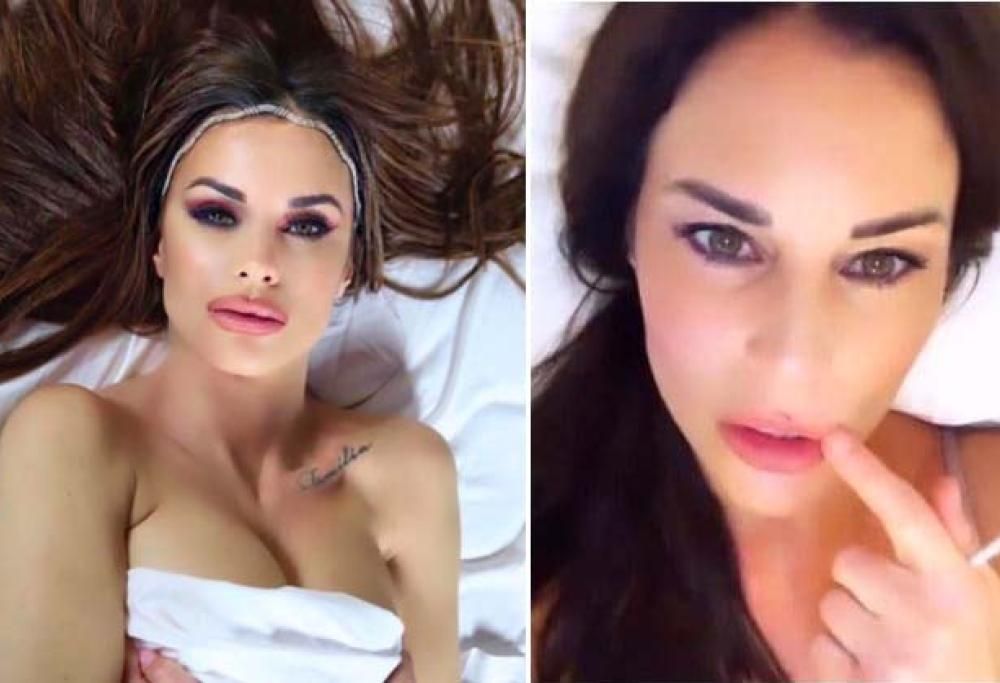 Antonella Mosetti rimuove l’acido ialuronico dalle labbra: “Erano enormi”