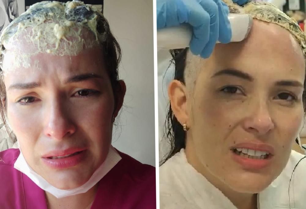 Mamma costretta a radersi dopo che uno sconosciuto le ha incollato un cappello in testa