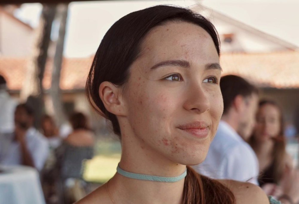 Aurora Ramazzotti pubblica una foto senza filtri: “Per postare una foto così, come l’hai scattata, ormai ci vuole coraggio”