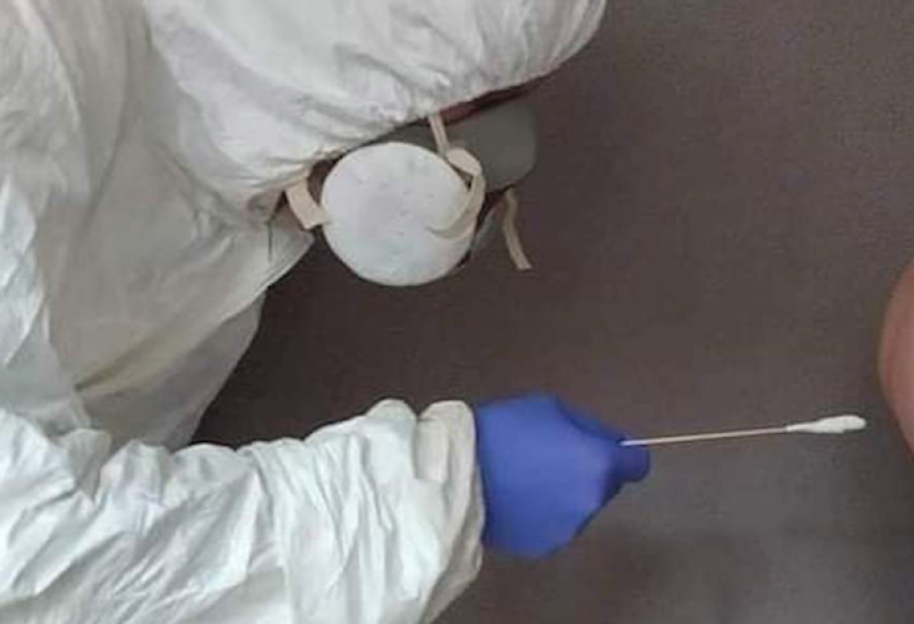 Tampone anale per scoprire il Covid: no, non è uno scherzo!