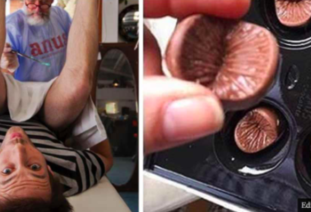 Ano in cioccolato: l’ultima follia