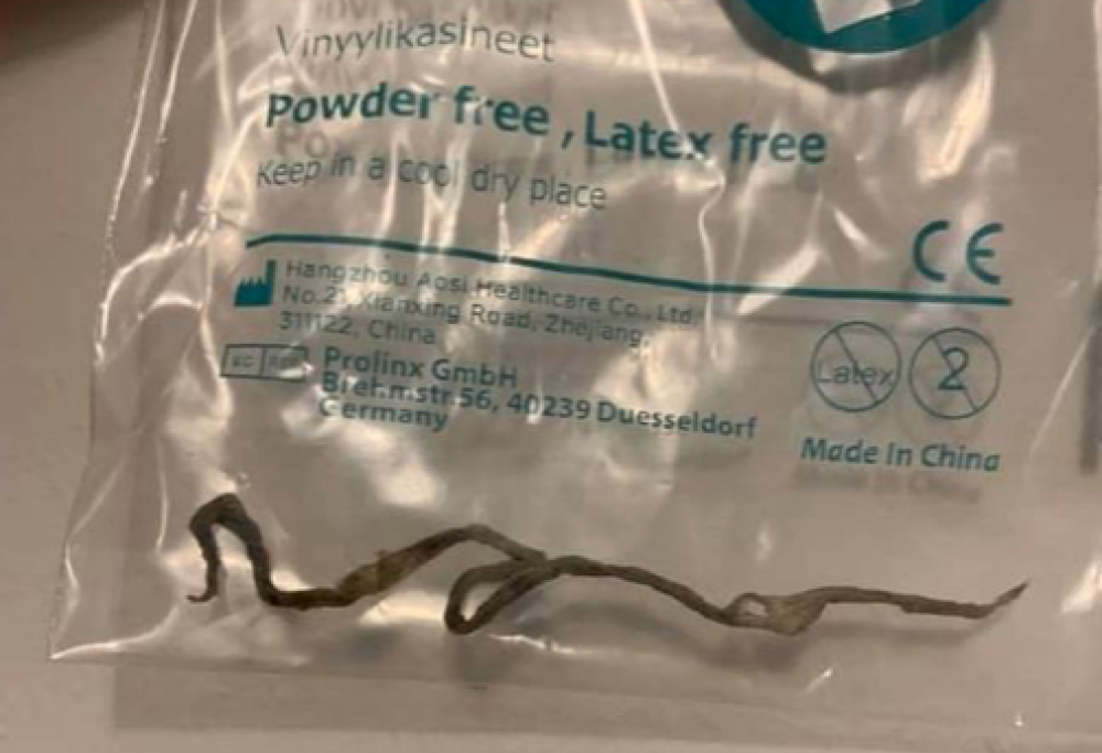 Mamma estrae uno strano verme dall’orecchio del figlio