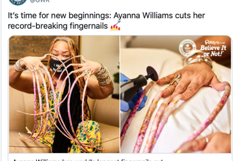 Si taglia le unghie dopo 30 anni