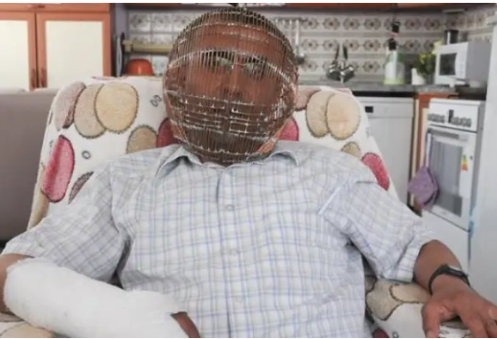 Si chiude la testa in una gabbia per non fumare più