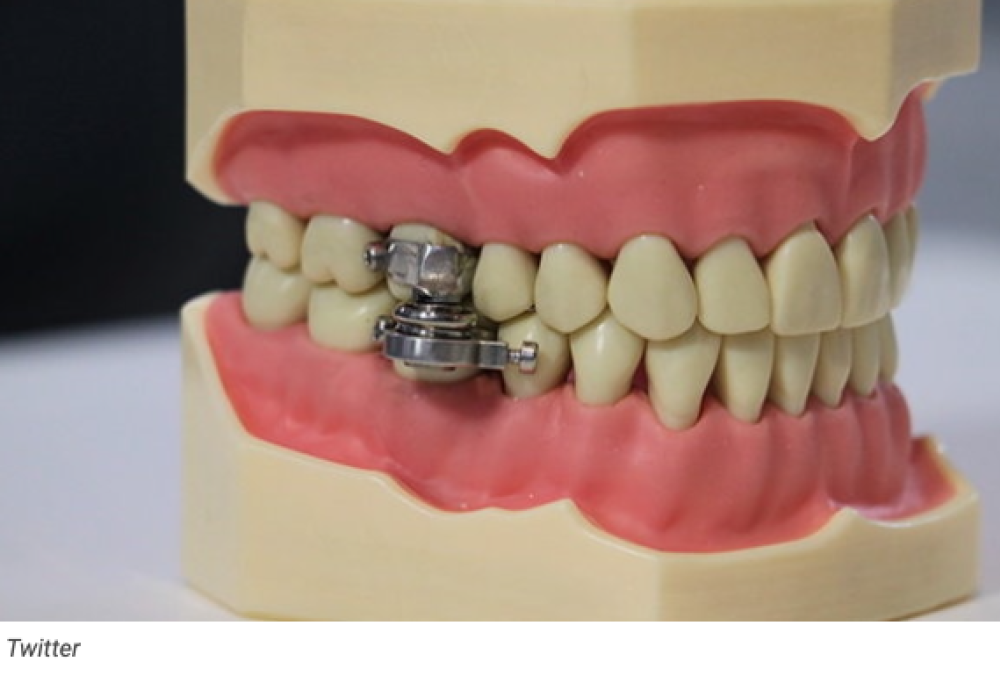 Magnete per impedire di mangiare