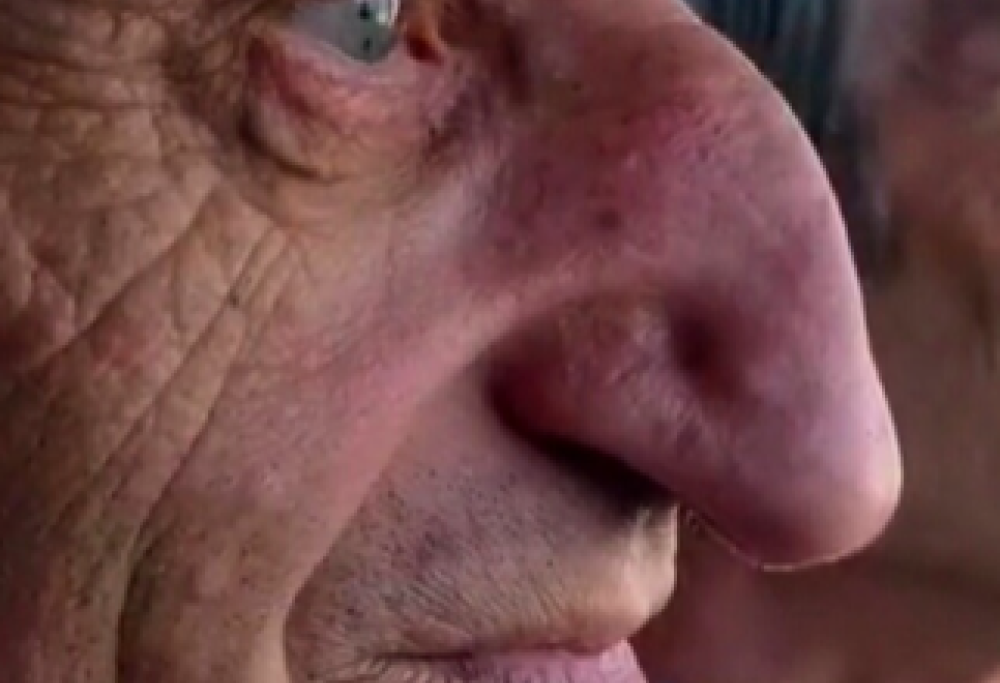 Più di 8 cm per il naso più lungo al mondo