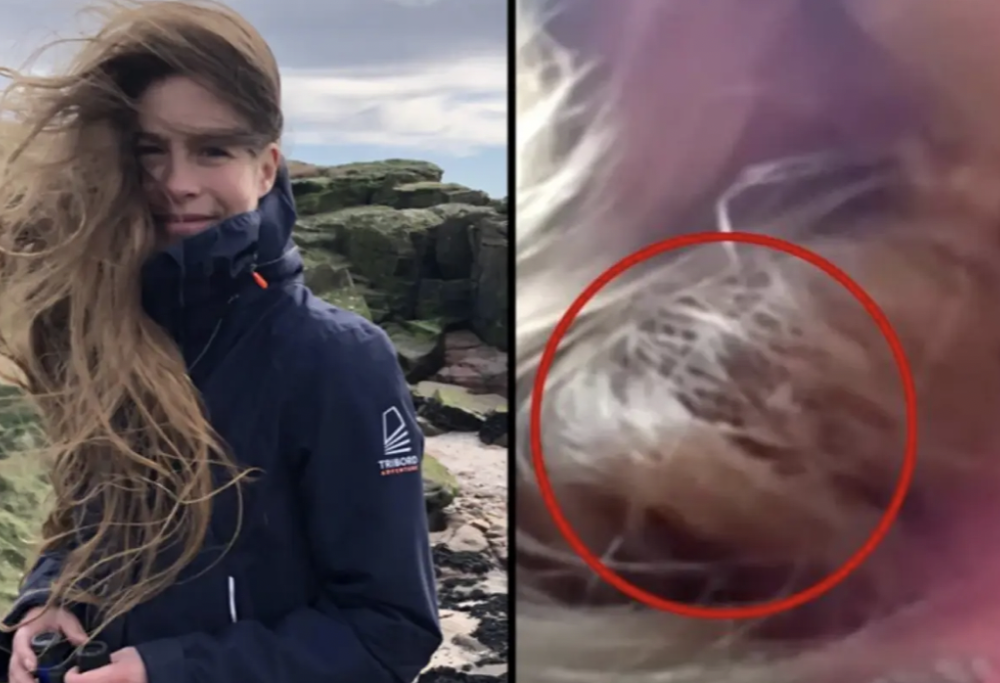 Ospita un uccello nei capelli per 84 giorni