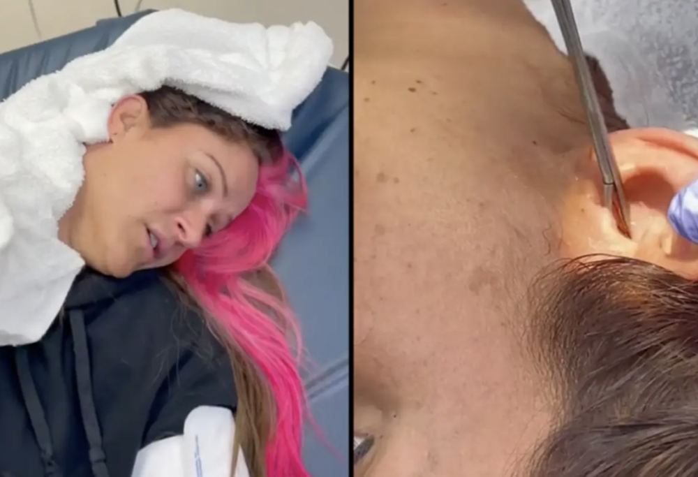 Le estraggono uno scarafaggio dall’orecchio