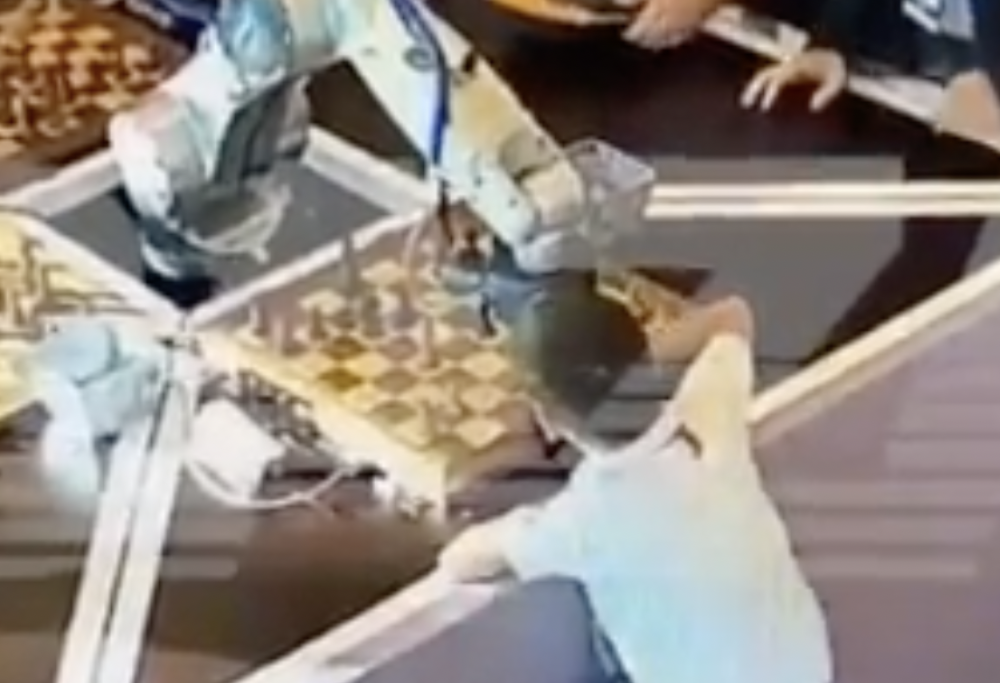 Robot spezza il dito a un bambino