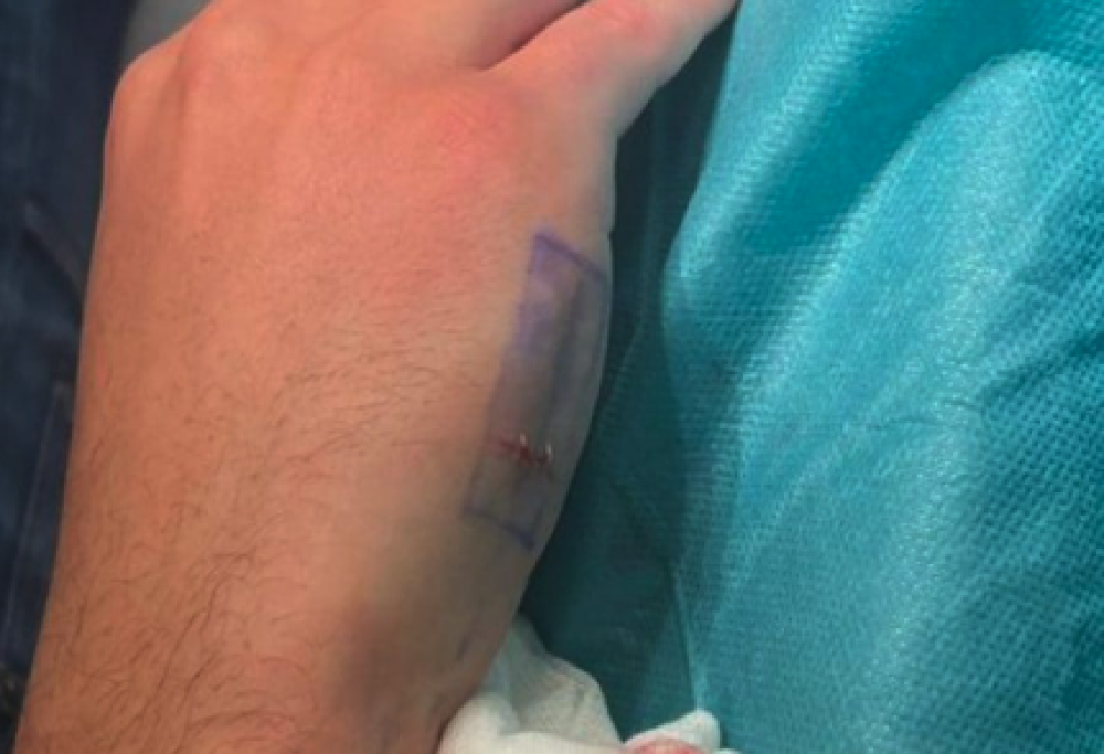 Svizzera, chip sotto pelle per pagare