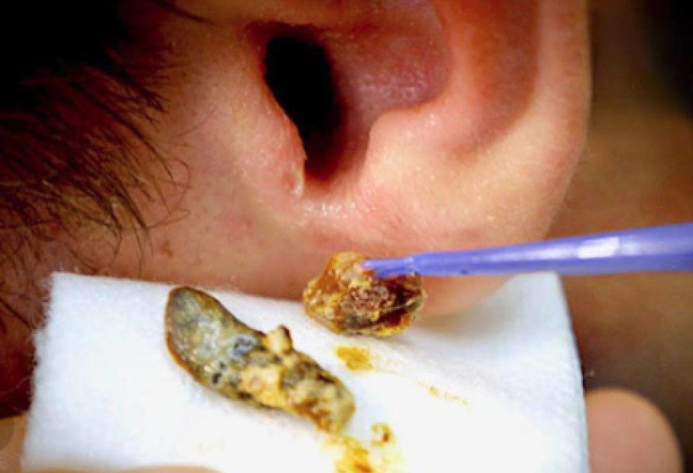 Lo stress si misura dal cerume