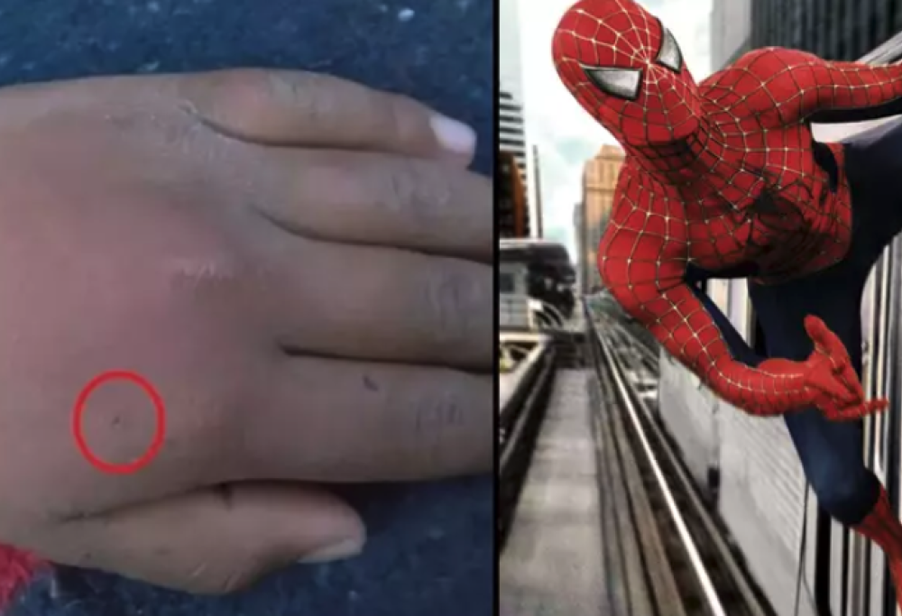 Si fa mordere da una vedova nera per diventare Spiderman