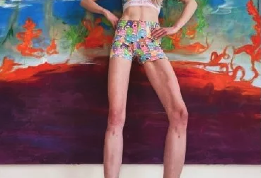 Modella tedesca si fa allungare le gambe di 14 cm