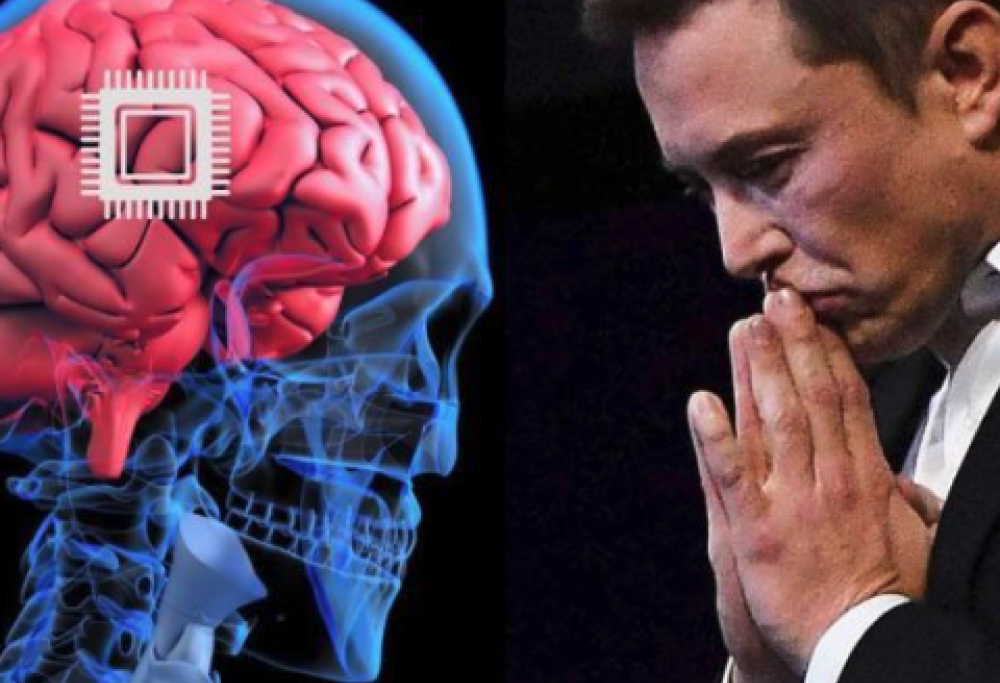 Elon Musk cerca volontari per i chip neurali