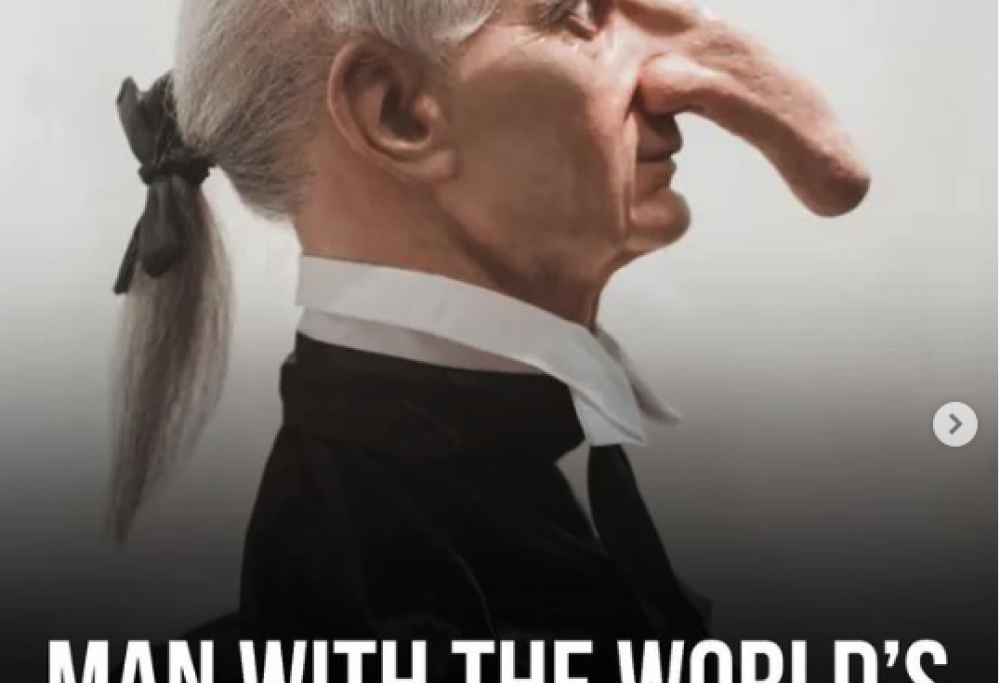 L’uomo con il naso più lungo della storia