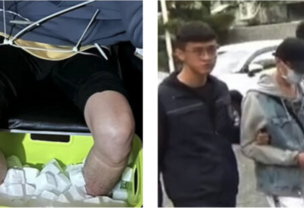 Si amputa le gambe per truffare l’assicurazione