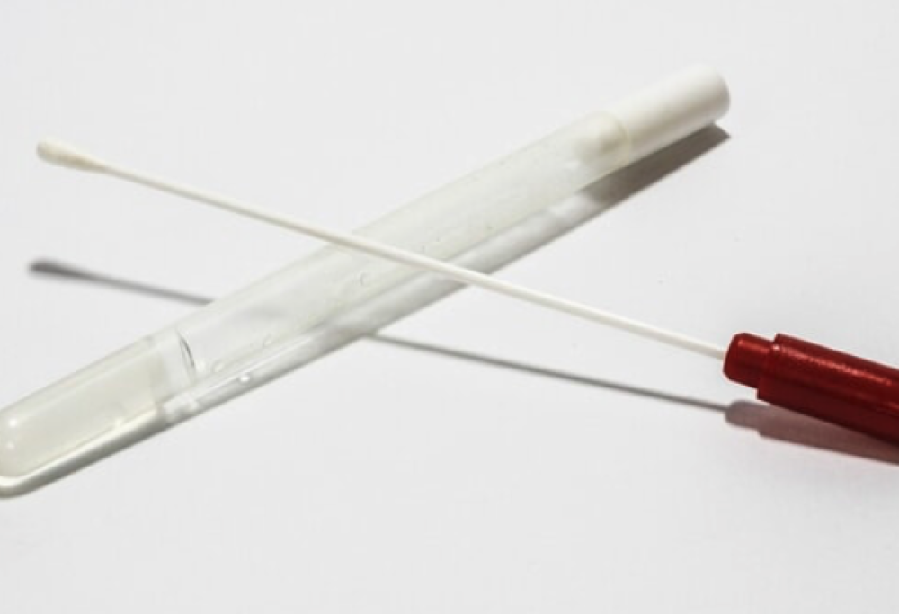 Il tampone orale che predice la morte