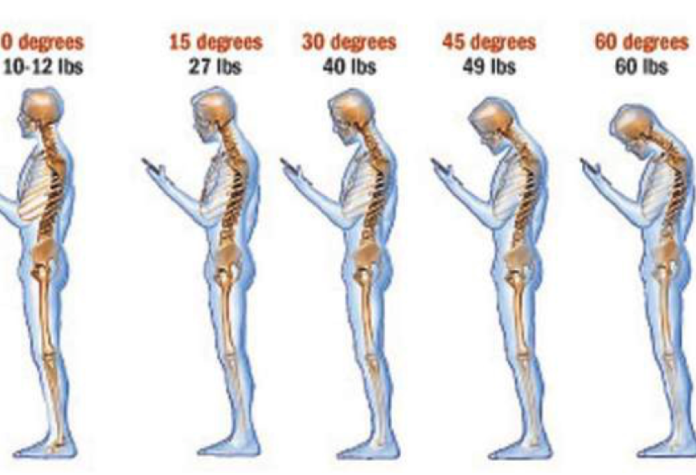 Attenzione al collo da nerd!