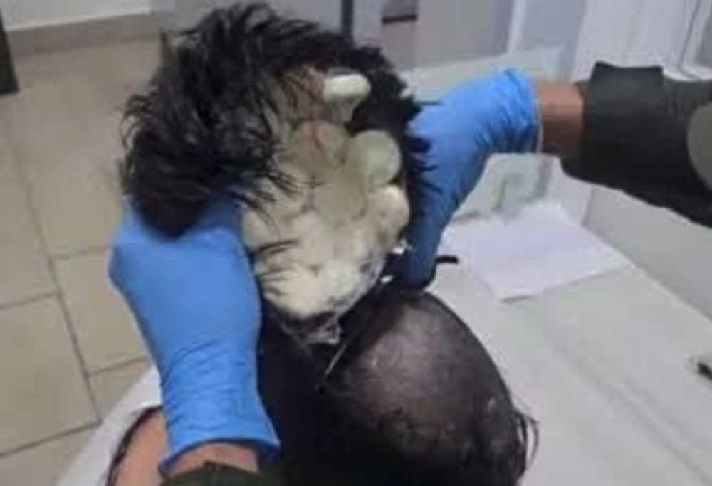 Nasconde la cocaina sotto al parrucchino