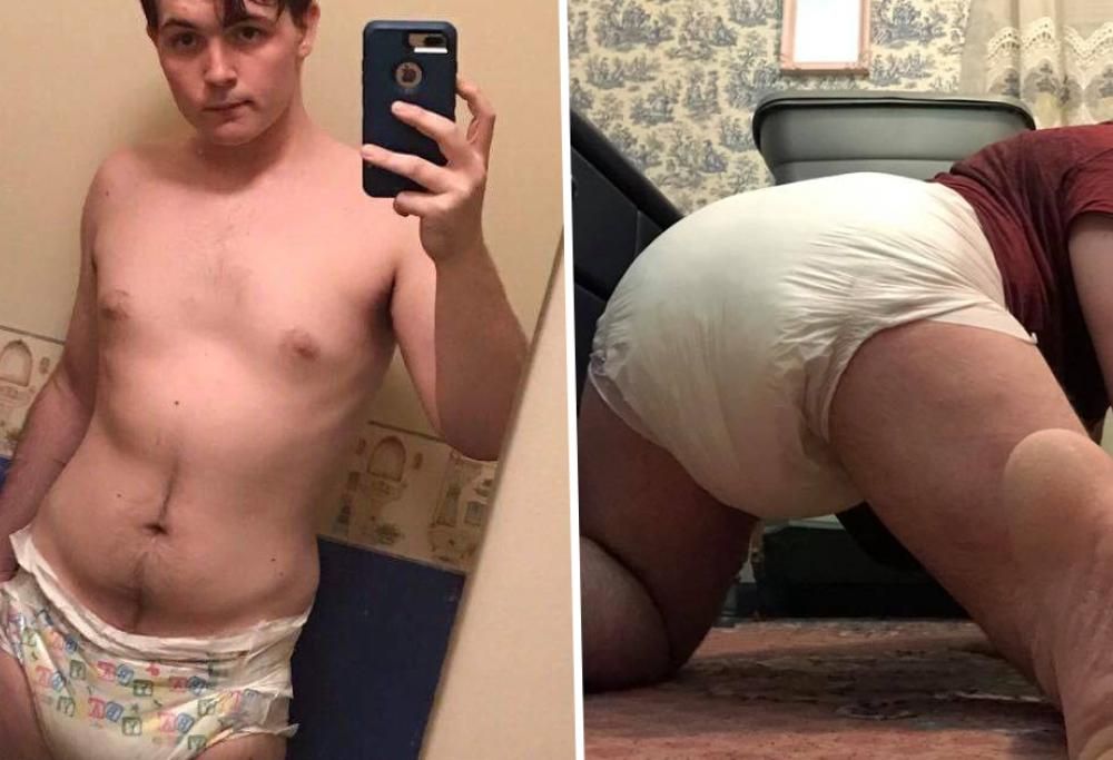 “Baby adulto” non trova lavoro per via del pannolino che indossa tutto il giorno