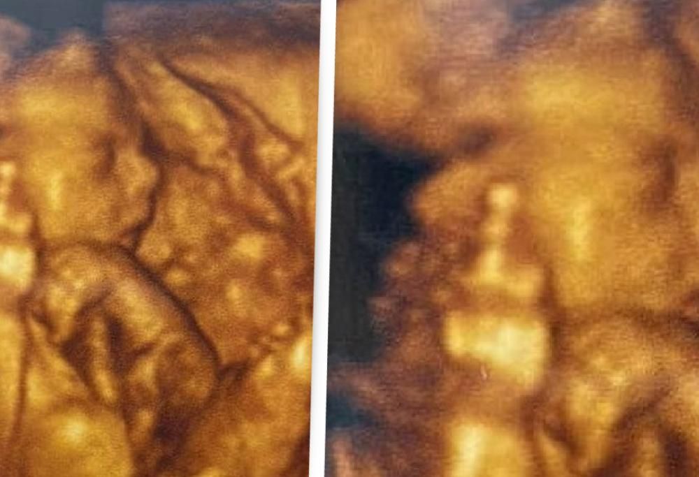 Bimba non ancora nato dice addio al 2021 a modo suo!