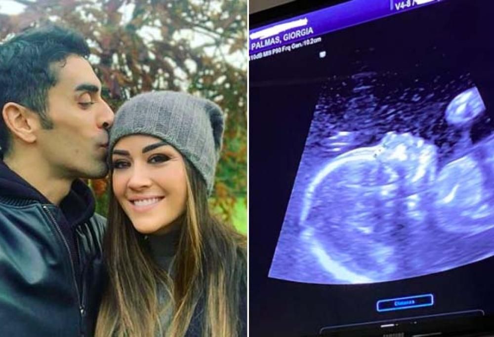 Giorgia Palmas è incinta e Magnini posta l’ecografia: è una bambina!