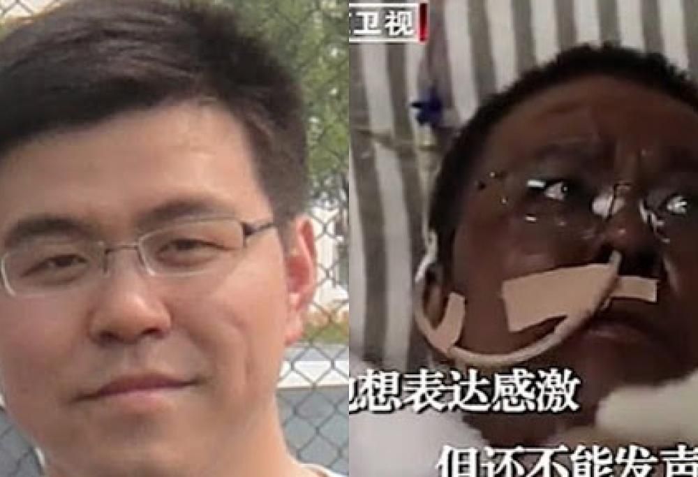 È morto il medico che si era risvegliato con la pelle scura dopo le cure per il Covid