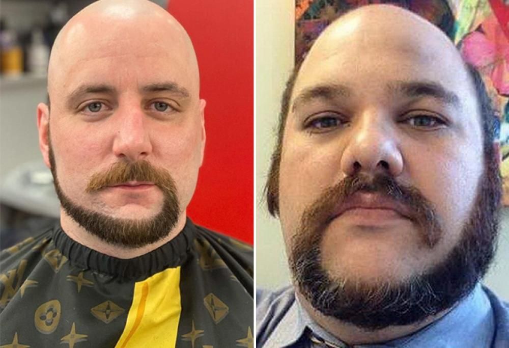 La barba a coda di scimmia è l’ultima tendenza del momento