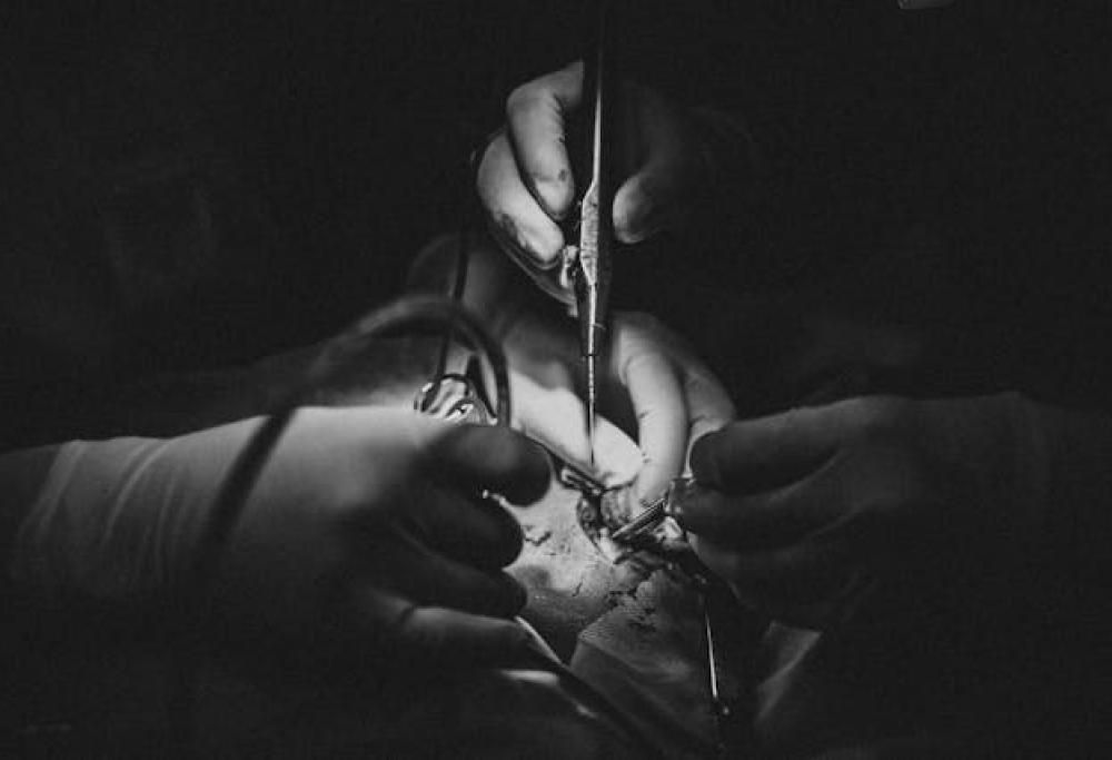 Donare un rene in cambio di 50mila dollari