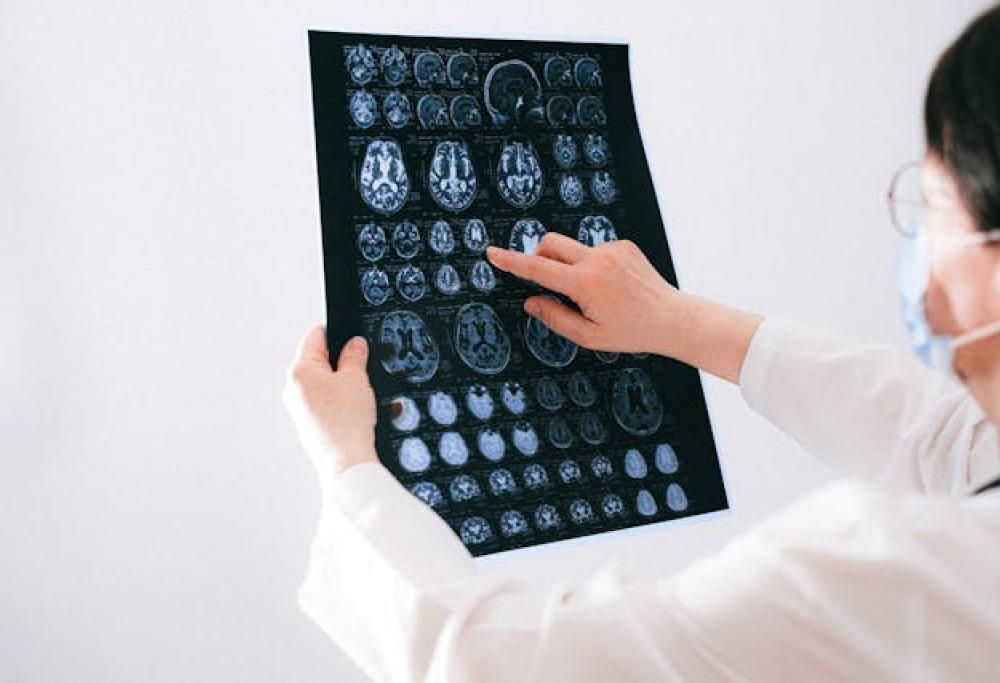 Lavorare troppo altera la struttura del cervello