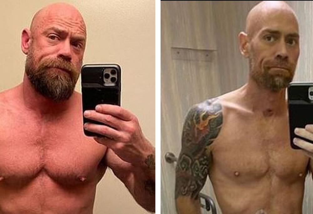 Paziente posta le foto choc del prima e dopo il suo ricovero per Covid-19