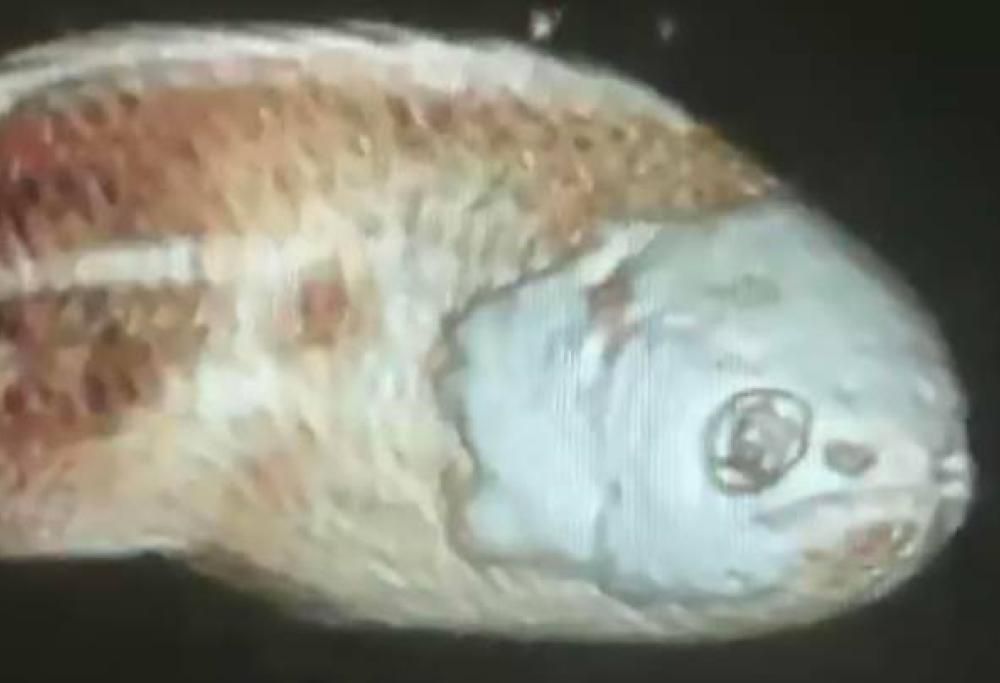 L’uomo si ritrova con un pesce bloccato nel retto dopo “essersi seduto sopra per caso”