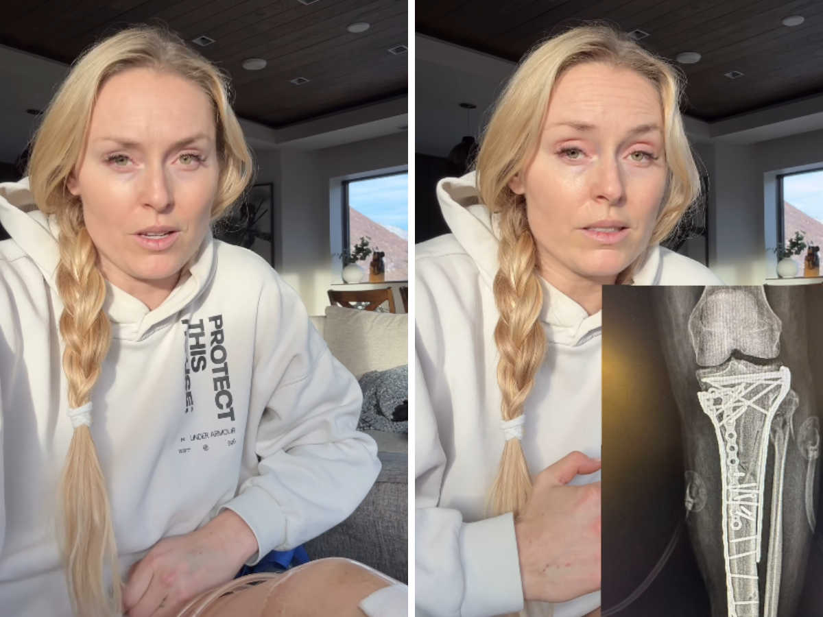 Lindsey Vonn shock: “Ho rischiato l’amputazione della gamba”