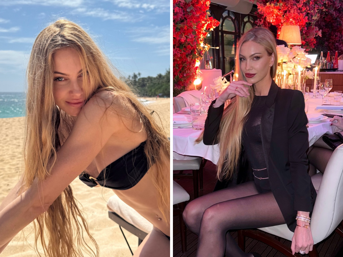 Taylor Mega e il botox: “Mi serve per non digrignare i denti”